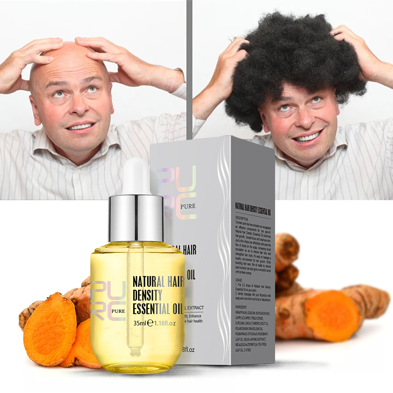 Ajoré PURC Ginger Hair Growth Oil — Natural Scalp Treatment for Thinning Hair & Hair Loss