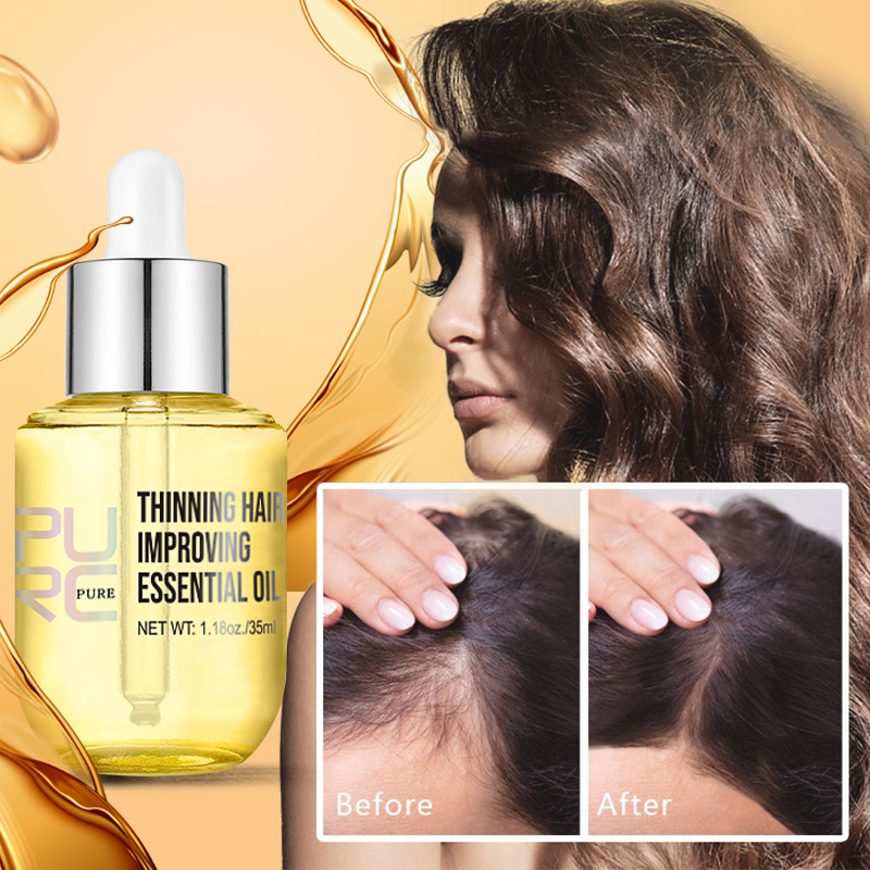 Ajoré PURC Ginger Hair Growth Oil — Natural Scalp Treatment for Thinning Hair & Hair Loss