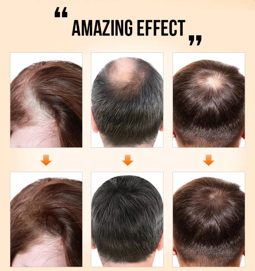Anti-Drop Nourishing & Repairing Hair Serum